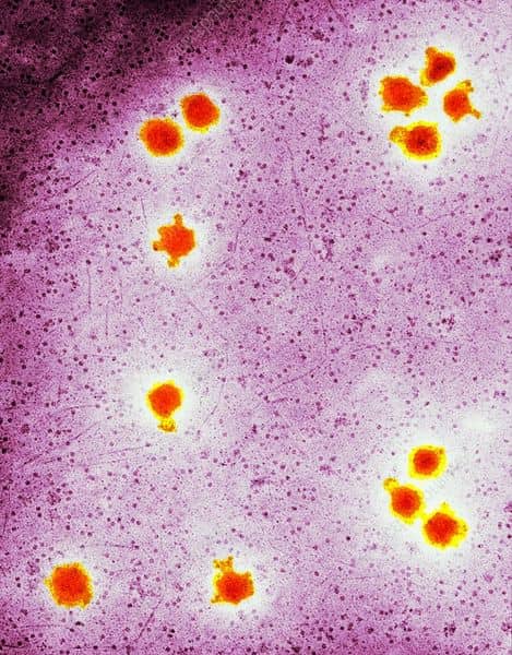 صورة مجهرية لفيروس الذبول التبقعي